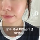 도로변(구로중앙로 135-6)(2) | 광주 여드름 관리 피부샵 아임뷰티에서 플라즈마 받은 후기