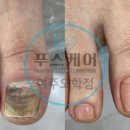푸스케어 여주오학점 - 135559 | 푸스케어 여주오학점