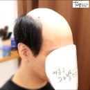 인모반가발 진짜 머리처럼 자연스럽게 착용 후기