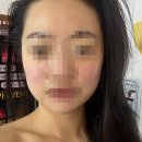 더퀸뷰티샵 | 문래 리프팅 맛집 I 더퀸뷰티라인 내돈내산 재방문 후기💗