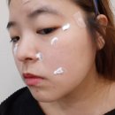 성서씨엘의원 | 대구 성서 씨엘의원 점빼기