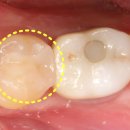 예스치과기공소 이미지