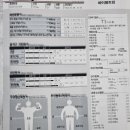 볼트짐 이미지