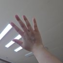 가톨릭이비인후과의원 | 조혈모세포 기증 &#34;반쯤&#34; 한 후기(유전자 일치 연락부터 중도 중단까지~)