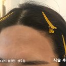 규 헤어라인