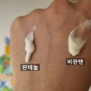 메디칼바른약국 | 덱스판테놀 연고 : 비판텐 vs D-판테놀, 같은 약 다른 느낌