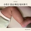 아이맘어린이병원 | 7개월 아기 수족구 확진 &amp; 완치 후기 l 다산 아이맘 어린이병원 오픈런