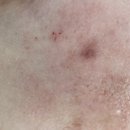 휴먼셀뷰티 홈케어피부관리 엑소좀페이스 리뷰 누누맘