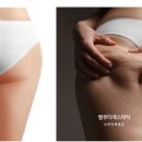 뷰티스타라인