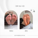 경산패디플래닝 추천 거칠고 갈라진 발뒤꿈치 순삭 중산동 뷰티다밍 패디플래닝 솔직 후기