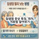 구강농산 | 침샘염 증상 특징, 위치, 치료법 알아보기