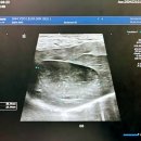 영스포렉스 | [강아지 췌장염] 3달 관리 후기｜복부초음파 재검 결과!