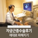 하늘씨엔씨주 | 자궁근종수술후기 제대로 파헤쳐봐요