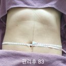 위더스트랜스 | 용인 산후마사지 추천/복직근 줄어듦/직접받아보고 작성한 솔직후기(위더스산후케어)