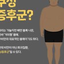 쿠싱증후군 증상 원인 치료방법 배만 볼록 갑자기 살찌는 희귀질환 이미지