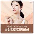 제이원성형외과 네이버블로그