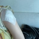 지우다피부과의원 | 강남역피부과 문신제거 1회차 후기