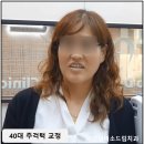 김종구희망드림치과의원 | 주걱 턱수술비용 3급 부정교합 교정 비교하면
