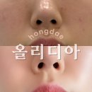 365하하병원 | 합정피부과 올리디아 팔자주름 시술 내돈내산 후기 | 자연스러운 콜라겐부스터 효과