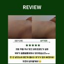 강남리슬림의원 | 잠실복부사후관리ㅣ지방추출주사 복부 바본 울퉁불퉁 뭉침, 단 1회 만에 매끈하게 ✨