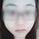 유앤미스킨케어 네이버블로그