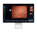 엔도메디 이미지