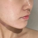 포메르에스테틱