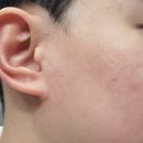 비엠(BM)에스테틱 | 고급미가 넘치는 창원 피부관리샵 BM스파 솔직후기