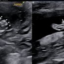 남중목욕탕 이미지