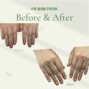 마정리 임광그대가 정문앞 | 인천 부평 삼산동 네일 꼼꼼관리 젤네일 후기 삼산동 수빈네일