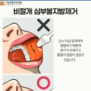 그림성형외과의원 네이버블로그