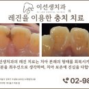 이선생 치과의원 네이버블로그