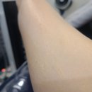어루다 | 부천웨딩관리 어루다 팔슬리밍 관리 만족 후기