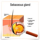 아카데미피부과의원 | 서면 여드름 피부과 진료, 네오빔 과연 효과적일까?