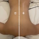 느티마을.경남빌라 | 수내역 에스테틱 선에스테스파 분당점 7회차 후기
