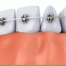 바른이예쁜이치과의원 이미지