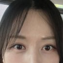 한 | 원래 쌍꺼풀 있는데도 자연유착 쌍수한 이유｜한 달 후기, 붓기·짝짝이 솔직 기록