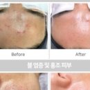 퀸에스테틱 이미지