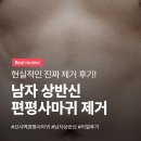 리얼스코프(주) | 압구정 편평사마귀 제거 제대로 받아본 말끔 후기