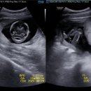 프라우삼성산부인과의원 이미지