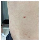 미소세탁 | 전주 아파트 옴진드기 방역소독 2차 집중작업 후기 (미소창방역)