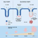 (수정) 중증치유를 돕는 식생활 기초상식...168-2 [ 여성들의 유전적 신체특성 . 위암세포 활성유전인자. 기타] 이미지