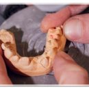 보일치과기공소 이미지