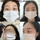 원주시장약국 | 원주 중앙동 : 온뷰티베리 원주 반영구 눈썹 후기