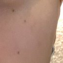 이지에이피부과의원 이미지