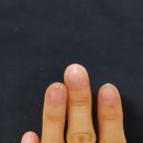 토핑네일