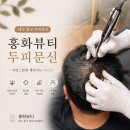 지금시작 뷰티hye | 대구 동구 두피문신 잘하는 곳, 홍화뷰티 SMP후기