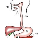 역류성식도염 이미지