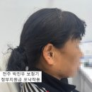 전주박진우보청기청각언어재활센터 | 정읍 보청기_ 청각장애 중증, 포낙 정부지원 제품으로