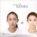 오페라성형외과의원 이미지